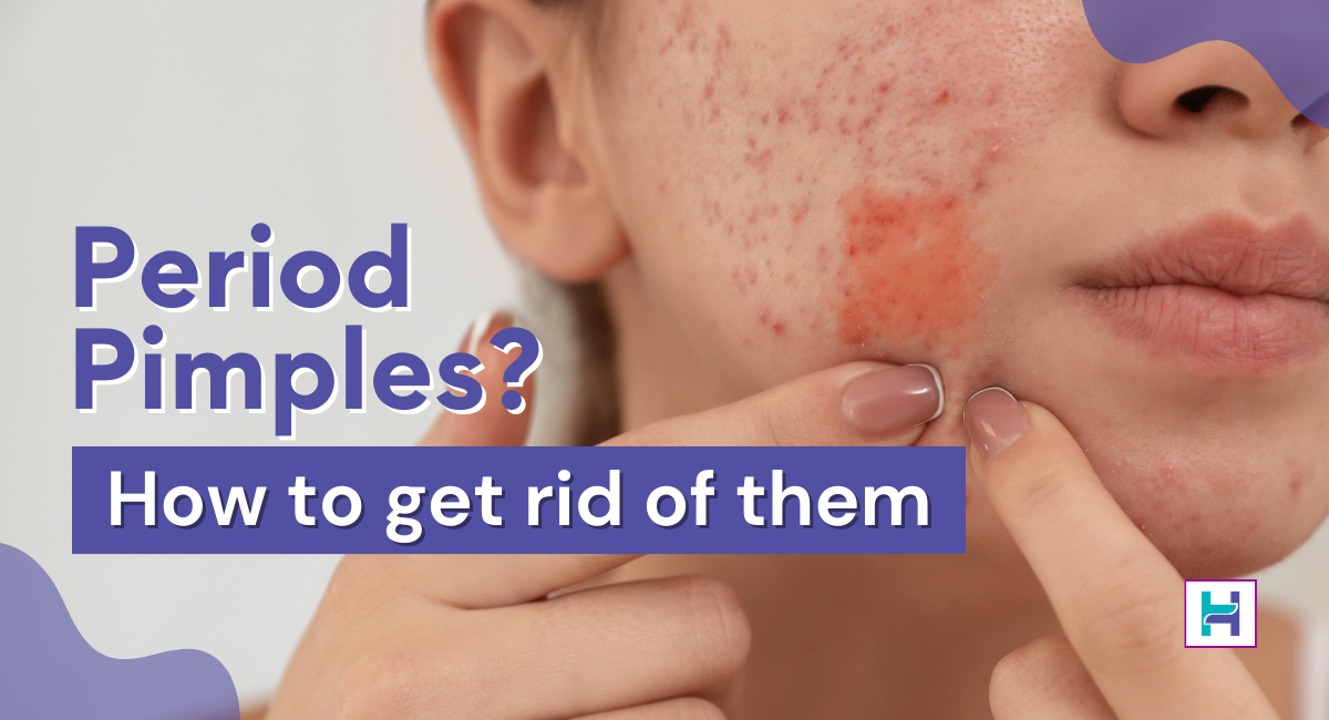 what-are-period-pimples-and-how-to-get-rid-of-them-healthfab